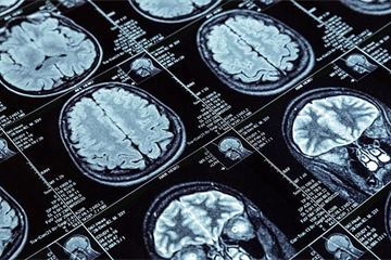 Brain power: how government can make the most of neurodiversity